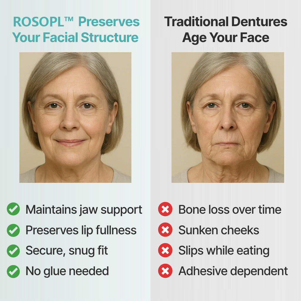 🌎Ends Today: 49% OFF!    Custom-Fit Full Functional DenturesMake you more confident✨