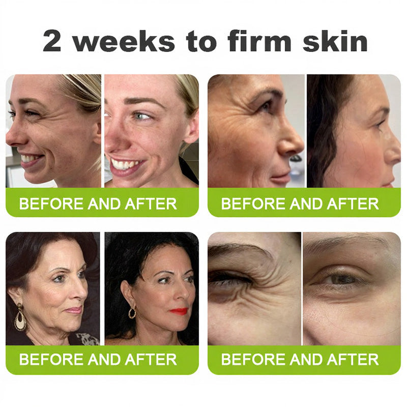 🧠👨‍⚕️Made and shipped from the USA 💫LOVILDS® Skin Tightening & Vita-A Retinol Retinol shot Anti-Wrinkle Firming Tightening cream - Last Day Promotion 49% OFF