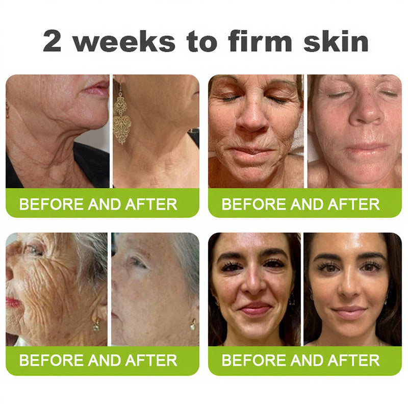 🧠👨‍⚕️Made and shipped from the USA 💫LOVILDS® Skin Tightening & Vita-A Retinol Retinol shot Anti-Wrinkle Firming Tightening cream - Last Day Promotion 49% OFF