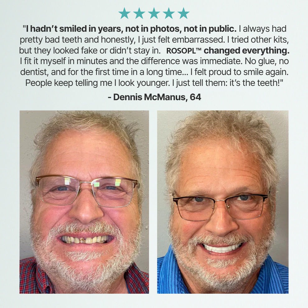 🌎Ends Today: 49% OFF!    Custom-Fit Full Functional DenturesMake you more confident✨