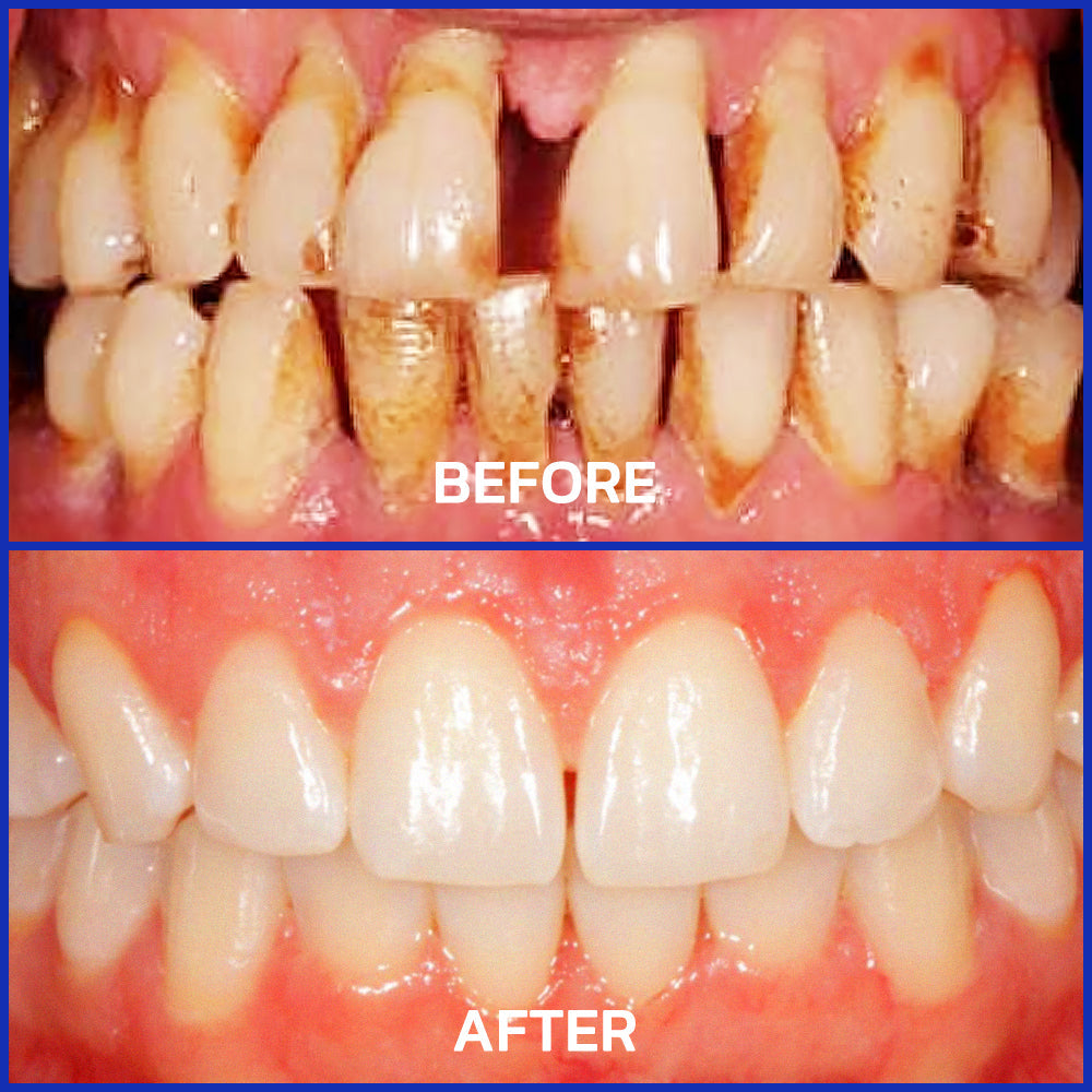 Rolimey® VioCore Bee Venom Dental Treatment Toothpaste
