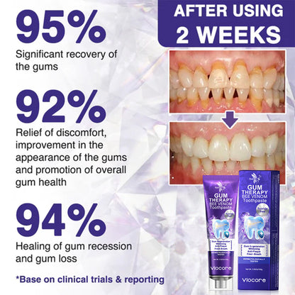Rolimey® VioCore Bee Venom Dental Treatment Toothpaste