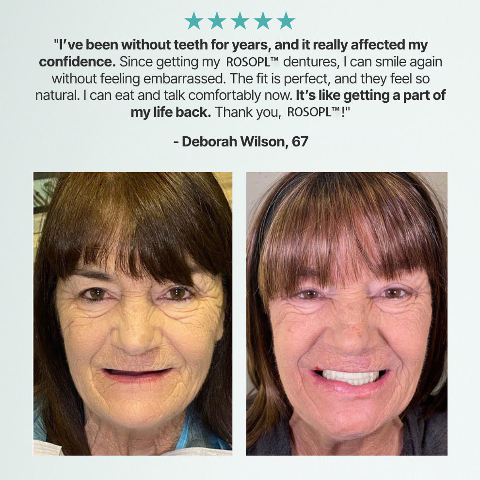 🌎Ends Today: 49% OFF!    Custom-Fit Full Functional DenturesMake you more confident✨